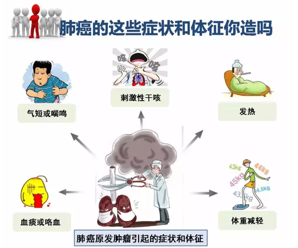 郑州治疗肺癌哪家好