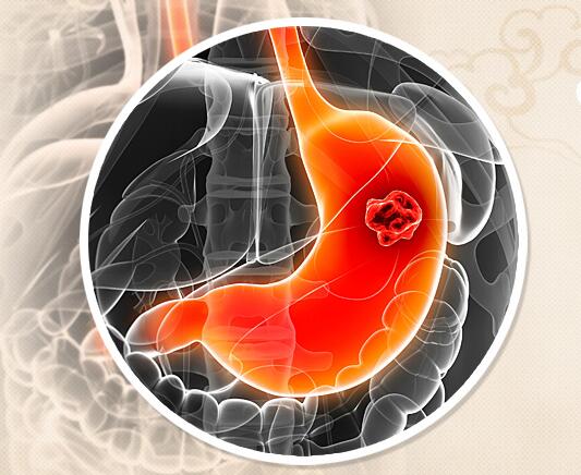 胃肿瘤中医怎么治疗